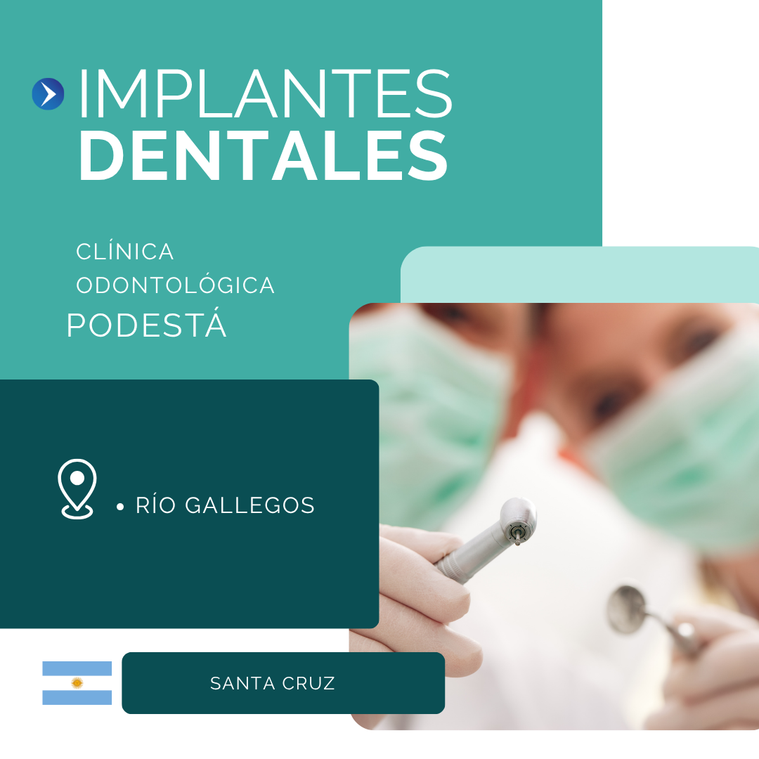 implantes dentales, Río Gallegos, Santa Cruz